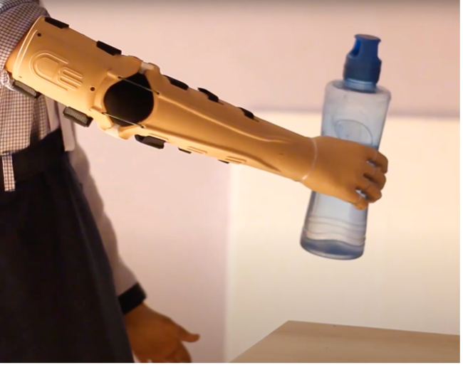 M.'s prosthetic arm gripping a water bottle