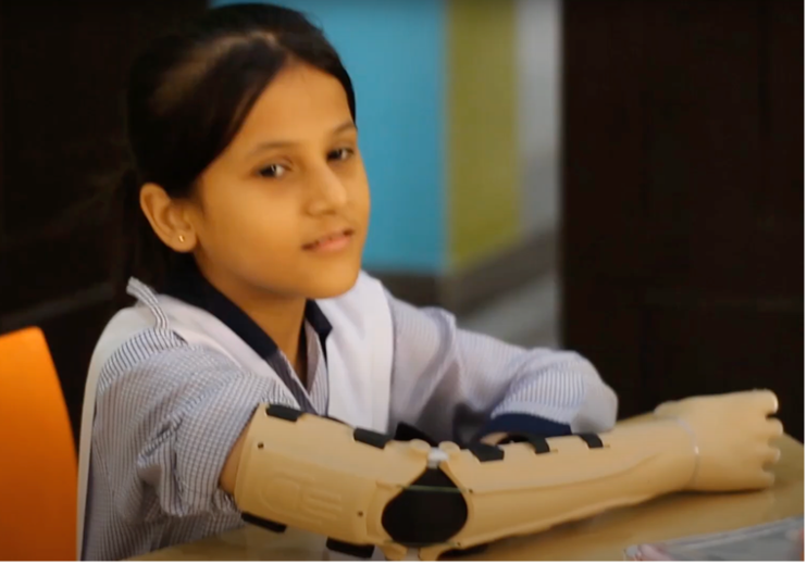 M. wearing her prosthetic arm at her school desk