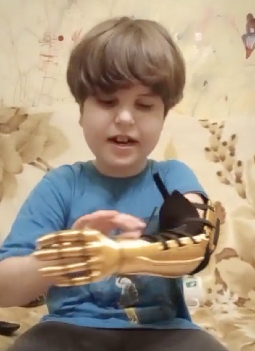 A. looking closely at the finger mechanism
