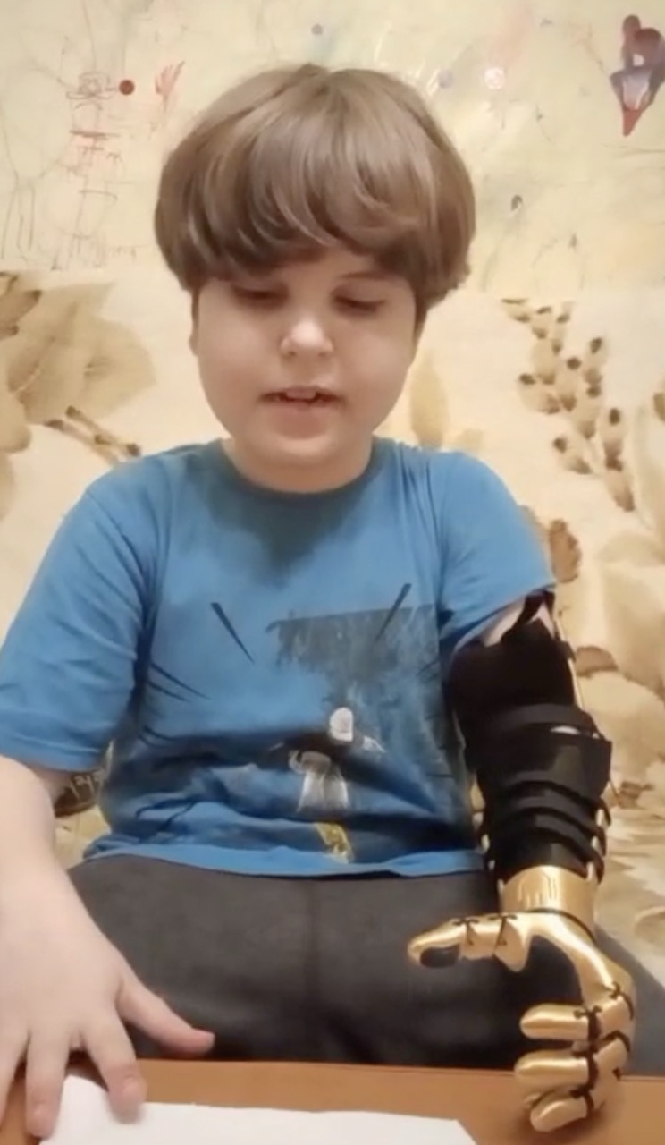 A. wearing the arm, full view showing fit
