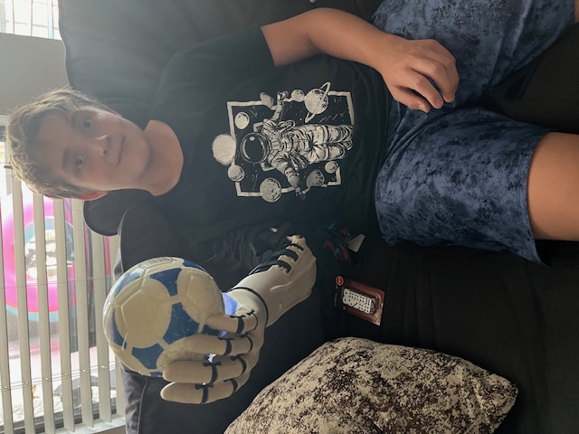 Mi. on the couch holding a soccer ball with his Kinetic Arm