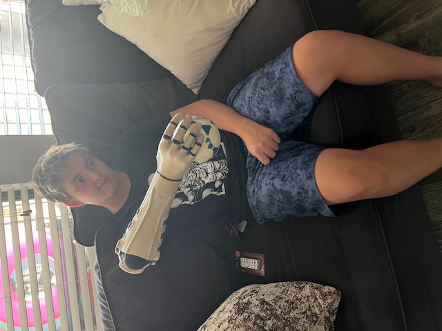 Mi. wearing the arm, looking at the mechanism