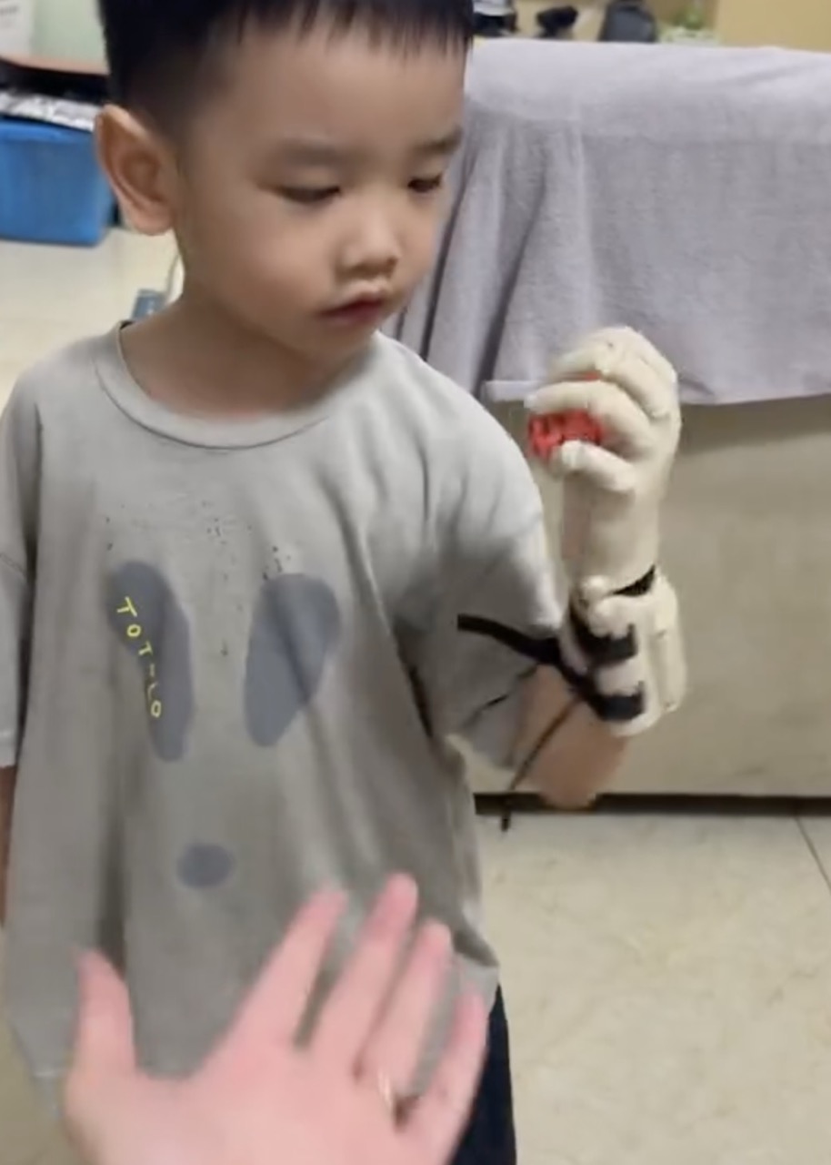 W. picking up a small red ball with his prosthetic hand on the first day