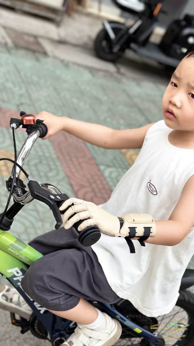 W. on his green bicycle, prosthetic hand on the handlebar, looking ahead