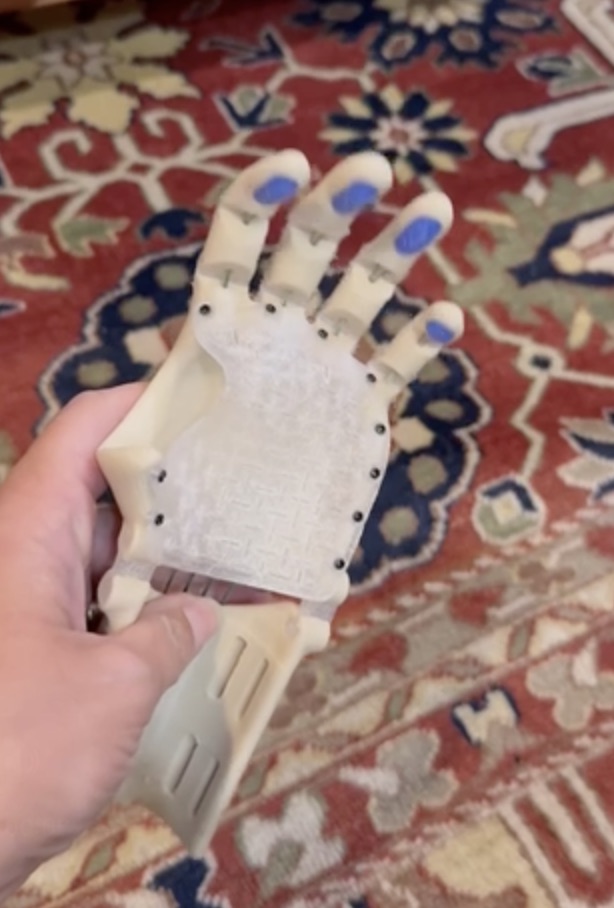 Thumbless hand, palm view showing velcro lining and blue TPU fingertips
