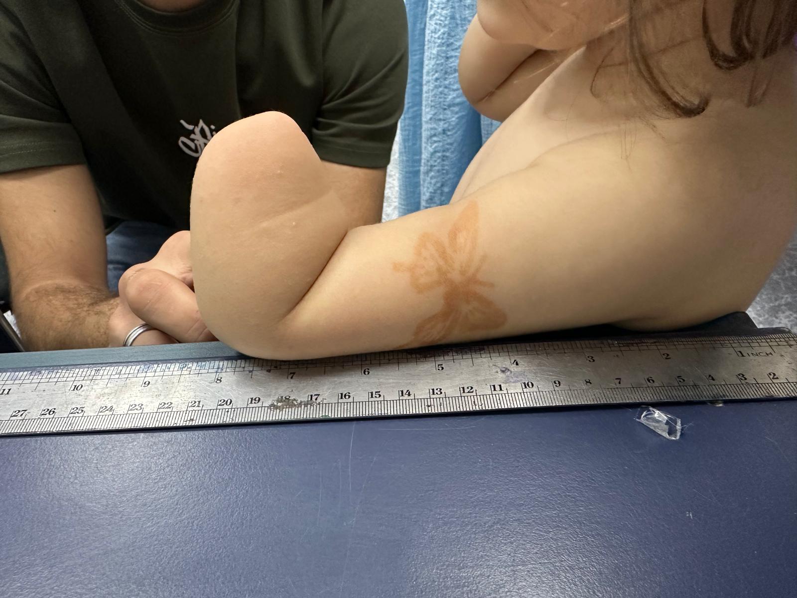 Measurement photo — S.'s arm close detail