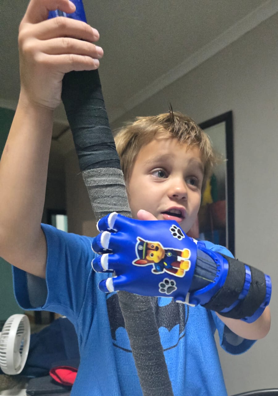 Noah holding up his dark blue prosthetic hand showing Chase from Paw Patrol stickers on the palm, concentrating on gripping a foam bat