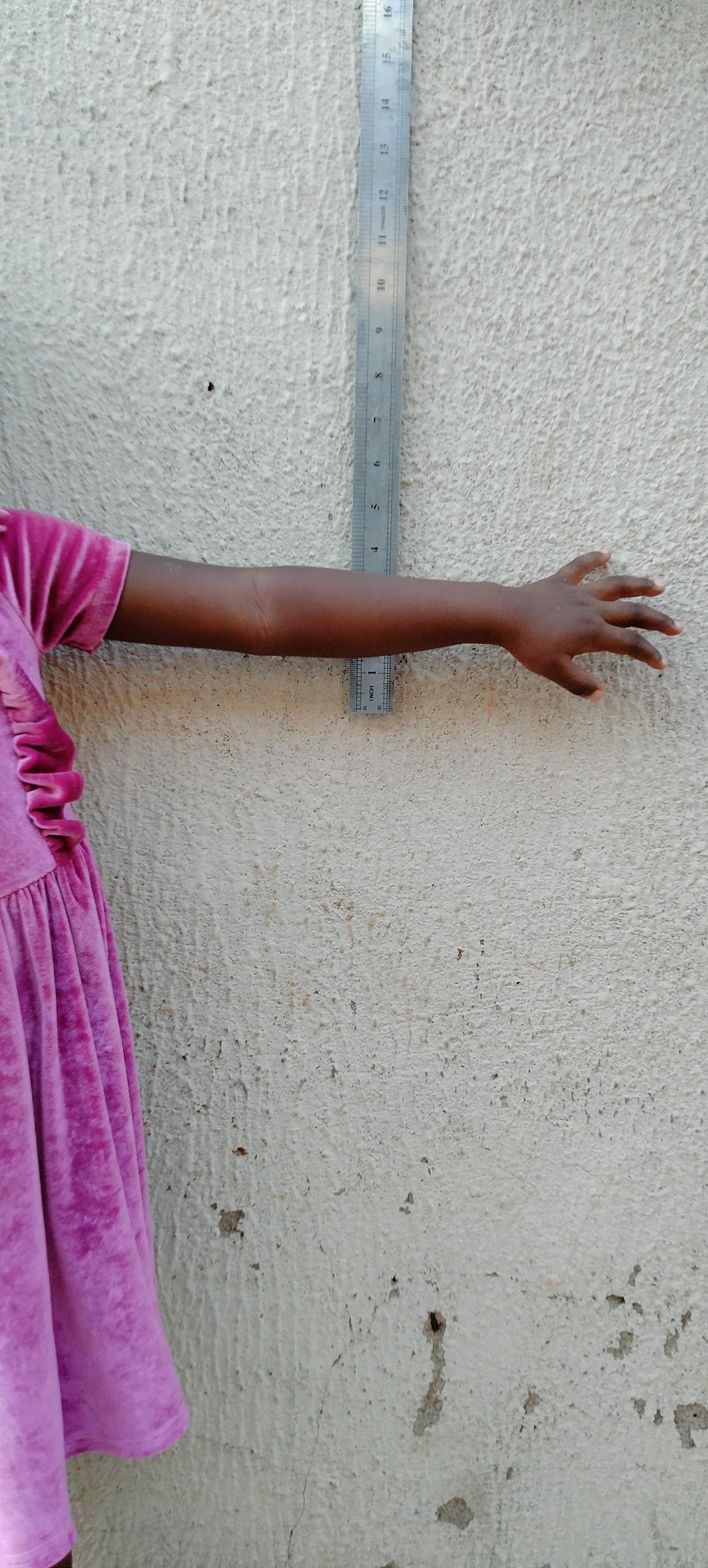 O.C. photographed from behind in a pink dress, arms raised, at the time of her original case submission