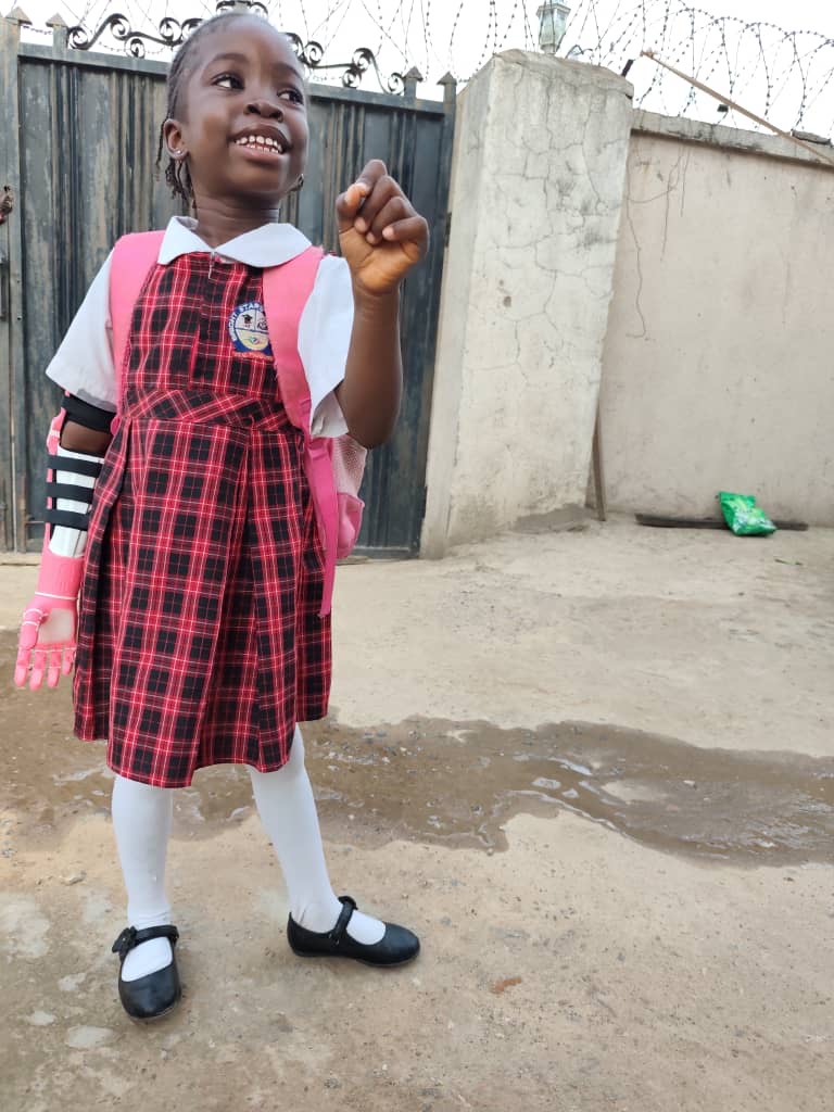 O.C. in school uniform, beaming with joy, pink prosthetic arm at her side
