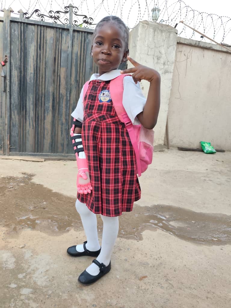 O.C. in school uniform pointing proudly at her pink prosthetic arm, Abuja Nigeria