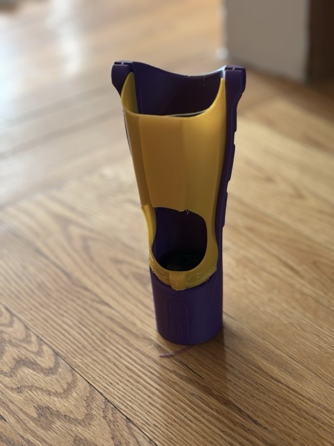 The modified purple and yellow socket showing the cutout designed to fit the curve of O.'s residual limb