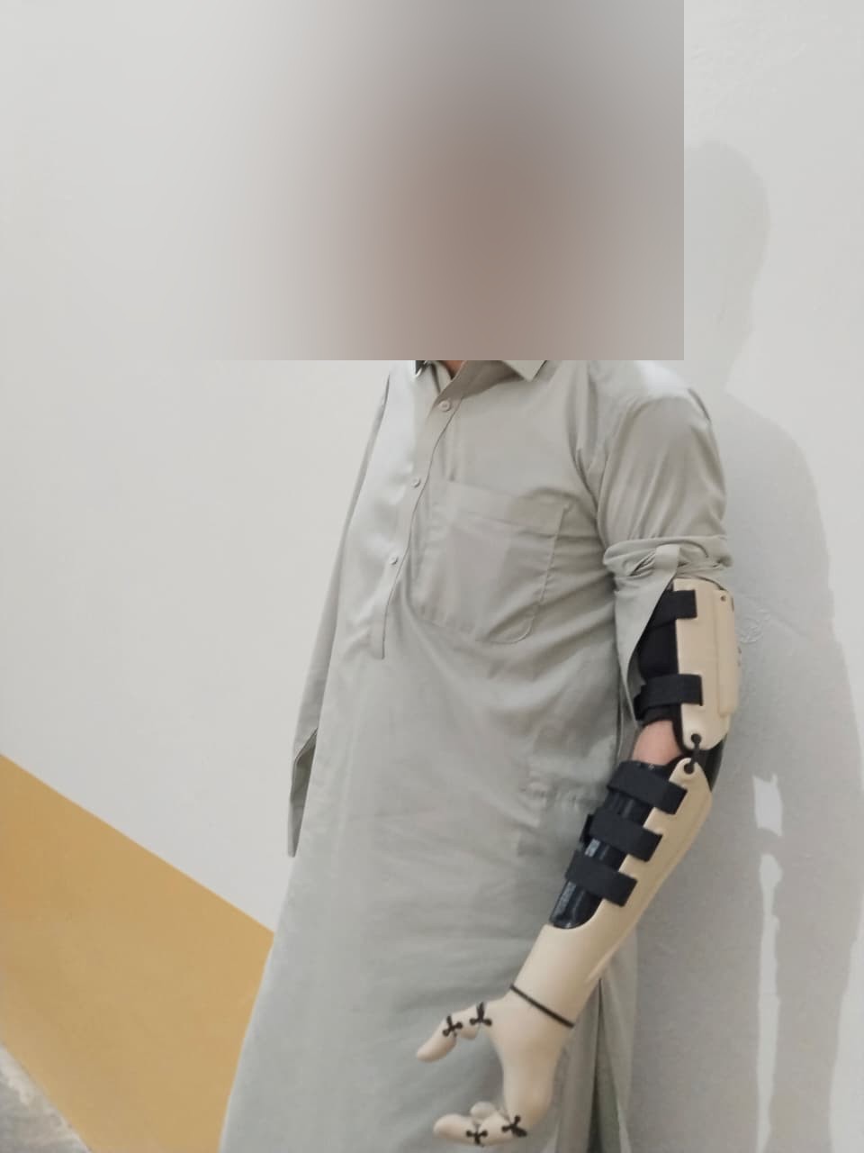 A.S. standing, side view, wearing the Kinetic Arm at his side